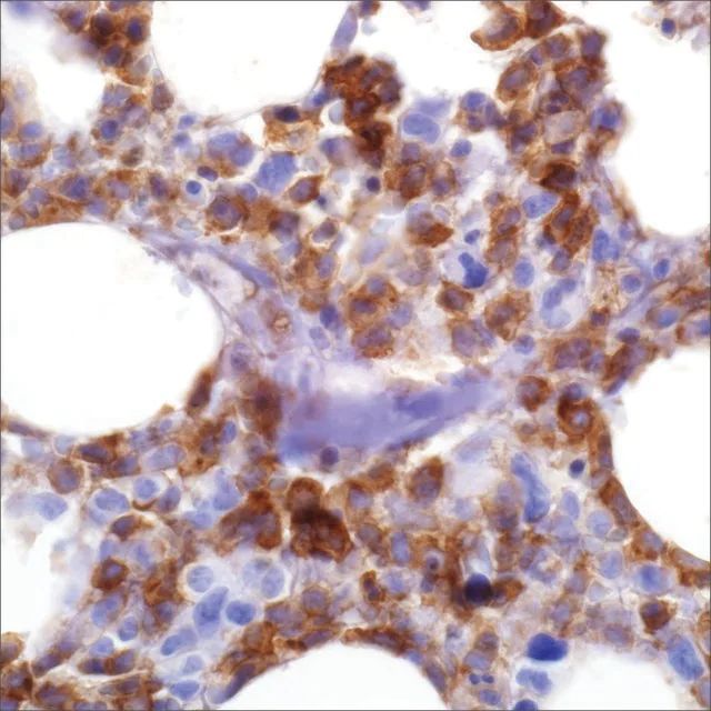 CD33 (PWS44) Mouse Monoclonal Antibody