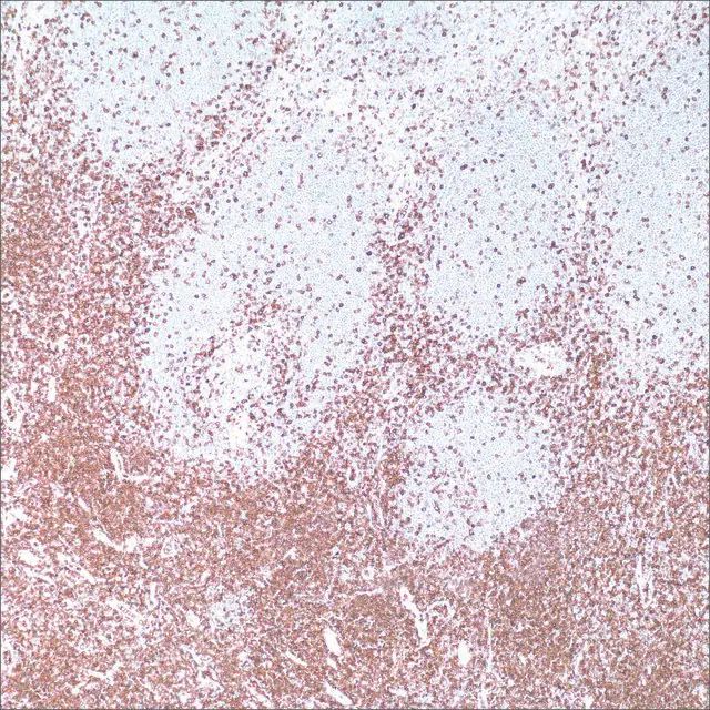 CD43 (MT1) Mouse Monoclonal Antibody