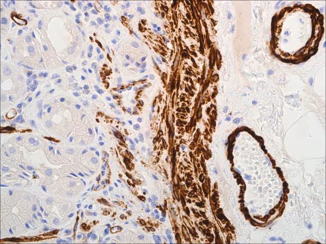 Myosin, Smooth Muscle (EP166) Rabbit Monoclonal Primary Antibody