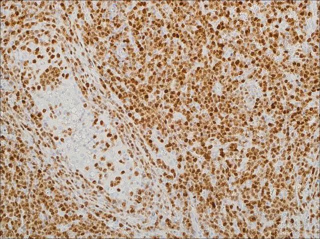 MUM1 (EP190) Rabbit Monoclonal Primary Antibody