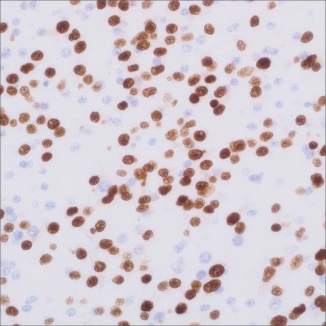 Olig2 (EP112) Rabbit Monoclonal Primary Antibody