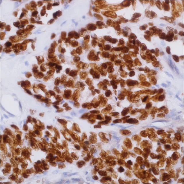 MyoD1 (EP212) Rabbit Monoclonal Primary Antibody