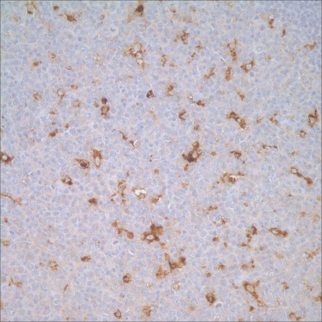 Lysozyme Rabbit Polyclonal Antibody