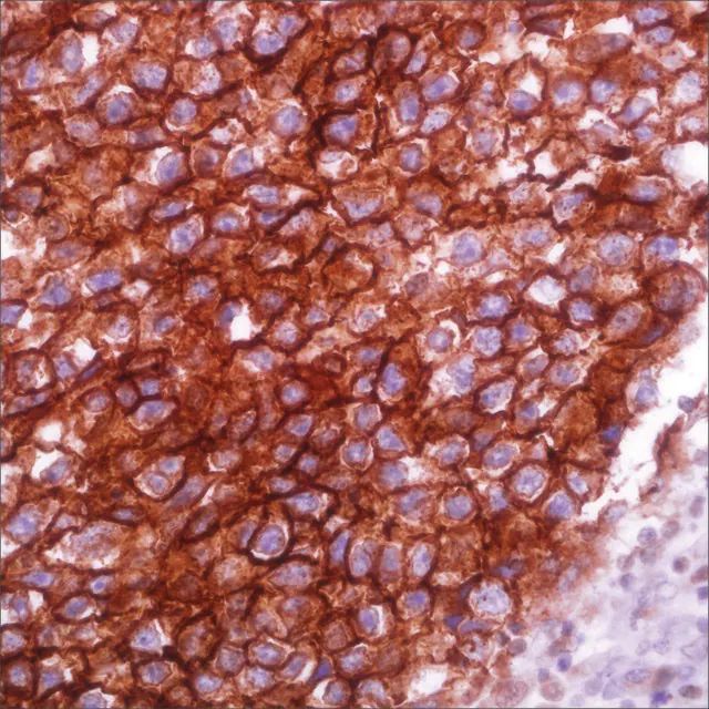 Podoplanin (D2-40) Mouse Monoclonal Antibody