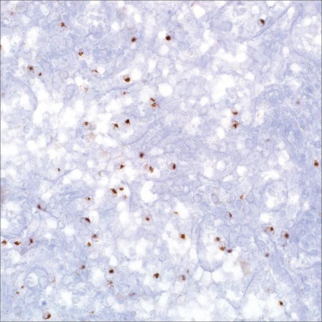 Perforin (MRQ-23) Mouse Monoclonal Antibody