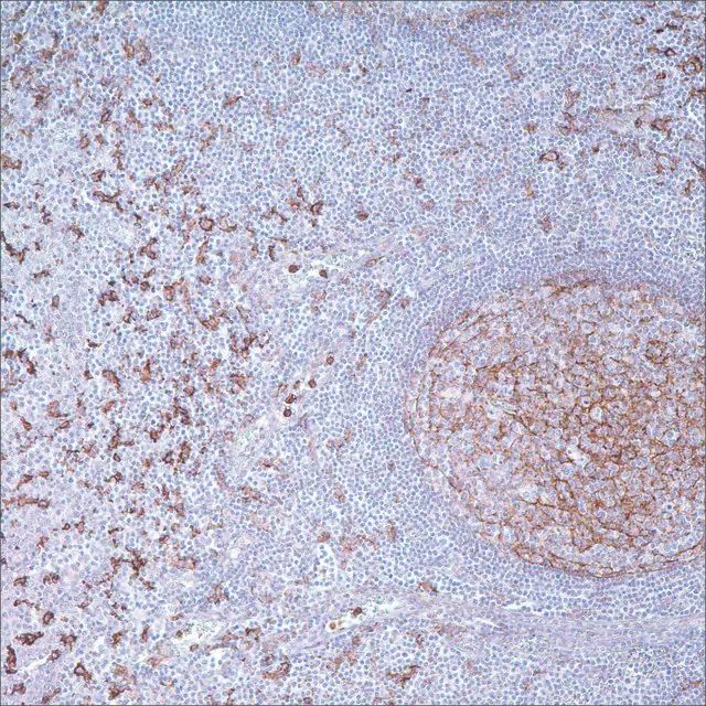 CD14 (EPR3653) Rabbit Monoclonal Primary Antibody