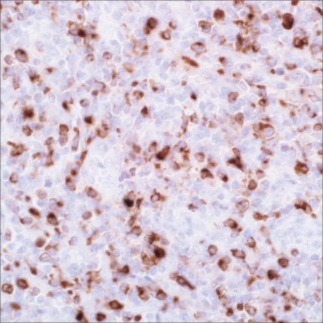 Granzyme B (EP230) Rabbit Monoclonal Primary Antibody