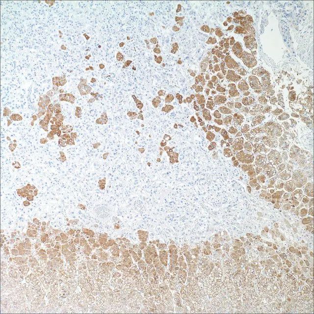 Inhibin, alpha (R1) Mouse Monoclonal Antibody