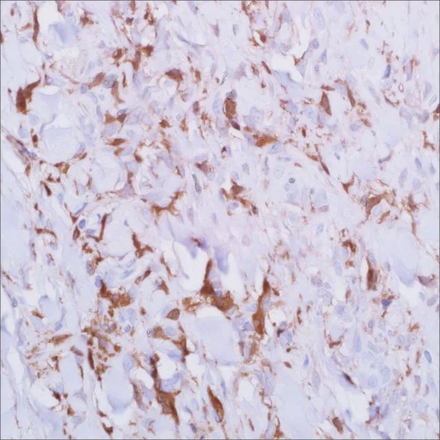 Factor XIIIa (AC-1A1) Mouse Monoclonal Antibody