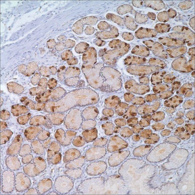 Gastrin Rabbit Polyclonal Antibody