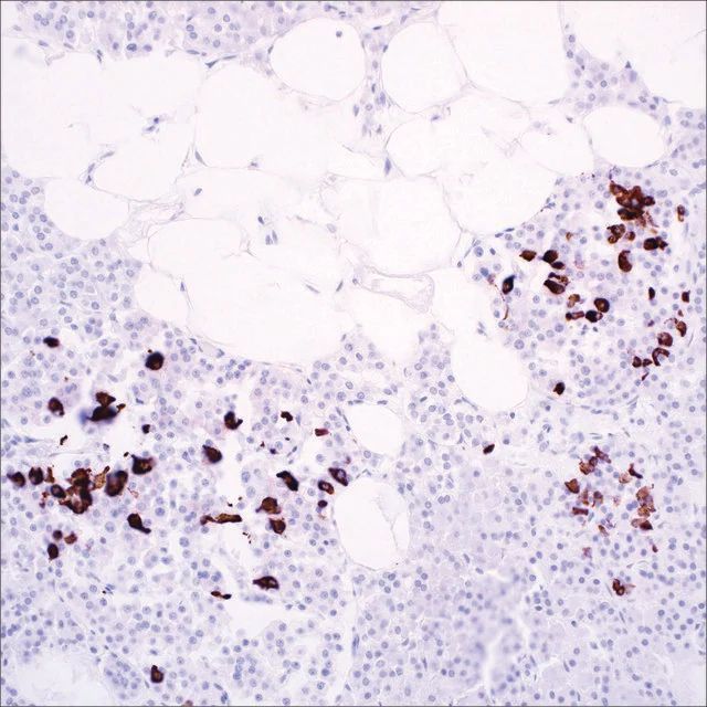 Somatostatin (EP130) Rabbit Monoclonal Primary Antibody