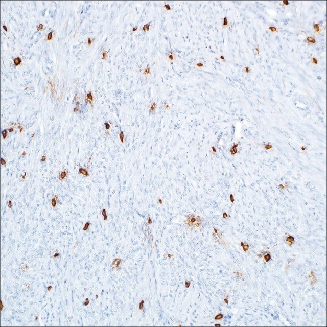 Tryptase (G3) Mouse Monoclonal Antibody