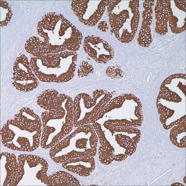 PSAP (PASE/4LJ) Mouse Monoclonal Antibody