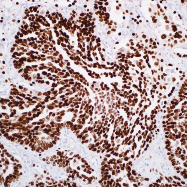 TTF-1 (EP229) Rabbit Monoclonal Primary Antibody