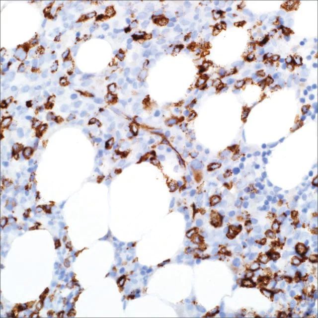 CD34 (QBEnd/10) Mouse Monoclonal Antibody