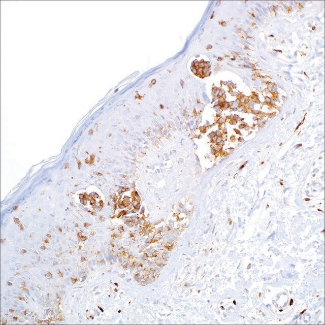 CD63 (NKI/C3) Mouse Monoclonal Antibody