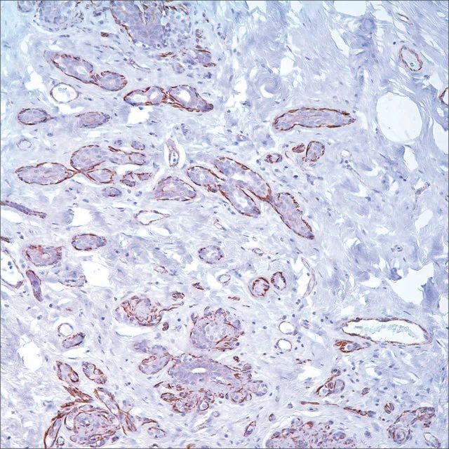 Caldesmon (E89) Rabbit Monoclonal Primary Antibody