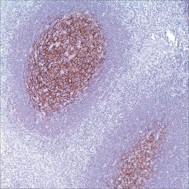 CD21 (EP3093) Rabbit Monoclonal Primary Antibody