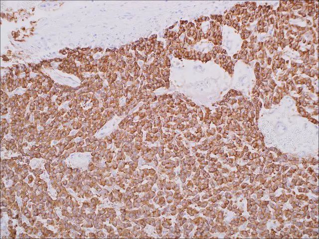 Synaptophysin (EP158) Rabbit Monoclonal Primary Antibody