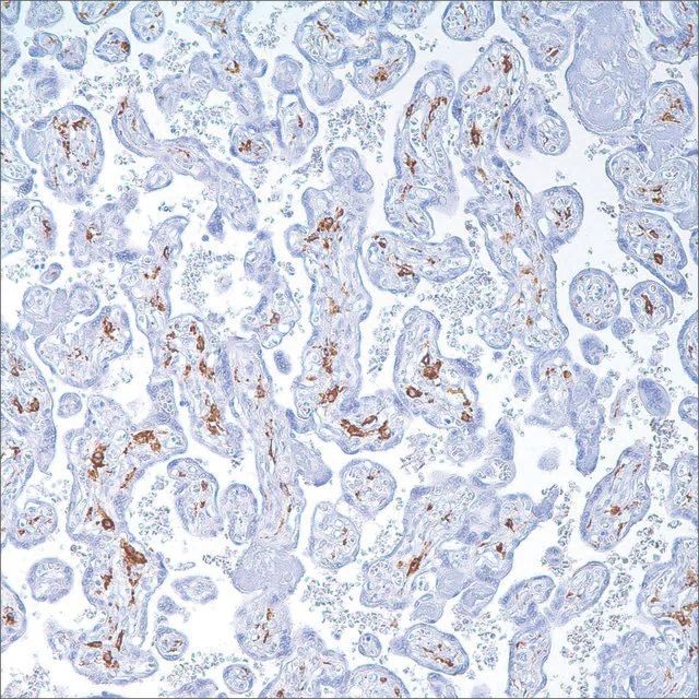 CD163 (MRQ-26) Mouse Monoclonal Antibody