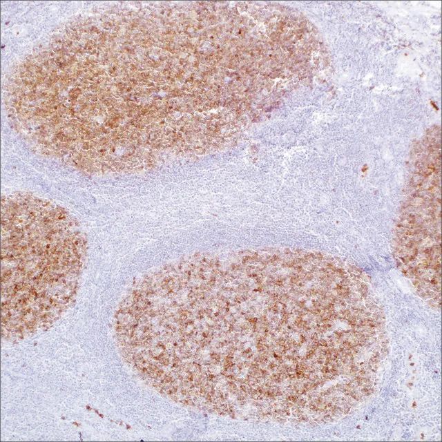 CD10 (56C6) Mouse Monoclonal Antibody