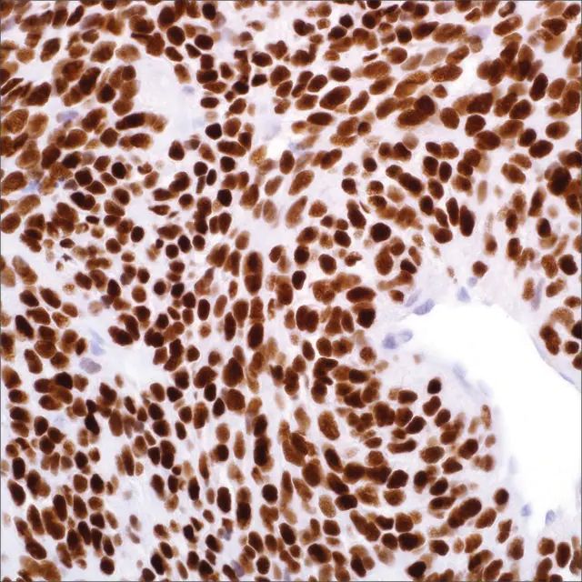 TLE1 (1F5) Mouse Monoclonal Antibody