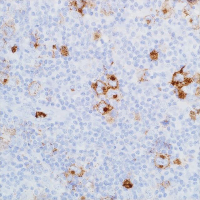 CD15 (MMA) Mouse Monoclonal Antibody