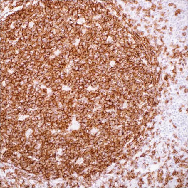 CD19 (EP169) Rabbit Monoclonal Primary Antibody