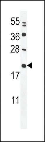 ANTI-MIA40(C-TERMINAL) antibody produced in rabbit