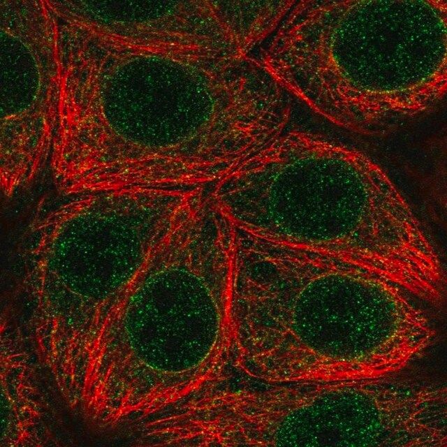 Anti-MLX antibody produced in rabbit