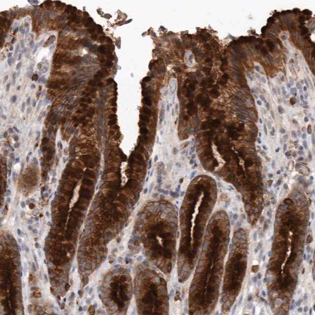 Anti-MLPH antibody produced in rabbit