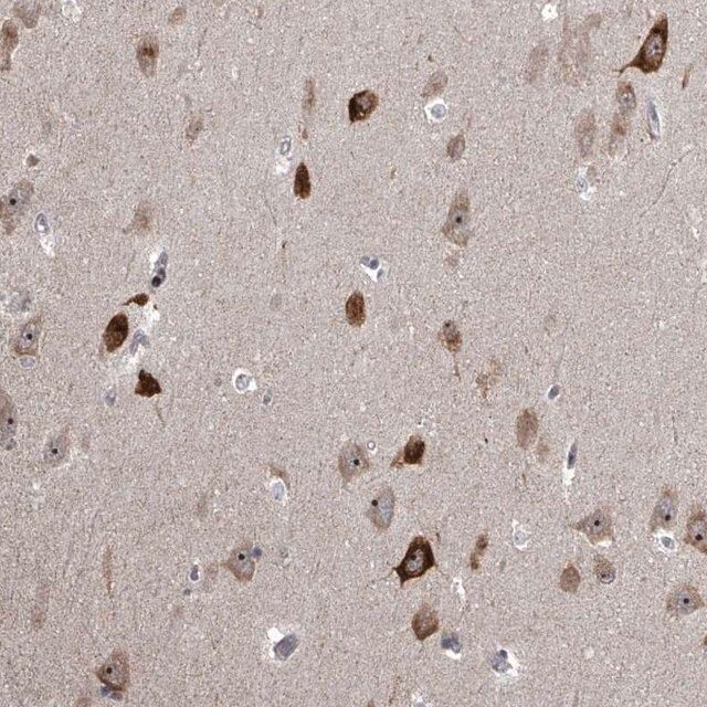 Anti-MLLT1 antibody produced in rabbit