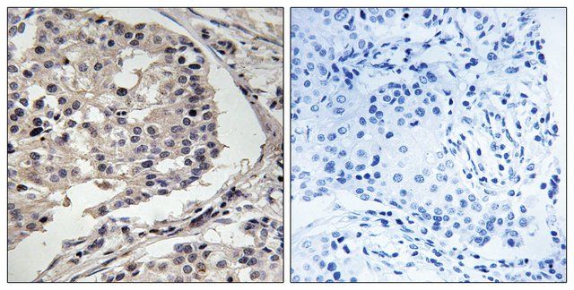 Anti-MLK1 antibody produced in rabbit
