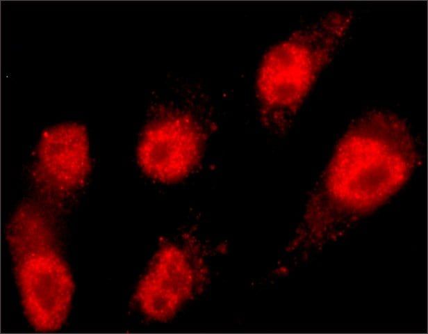 Anti-MLL2 antibody, Mouse monoclonal