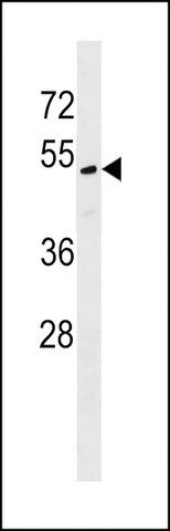 ANTI-MLF1IP(C-TERMINAL) antibody produced in rabbit
