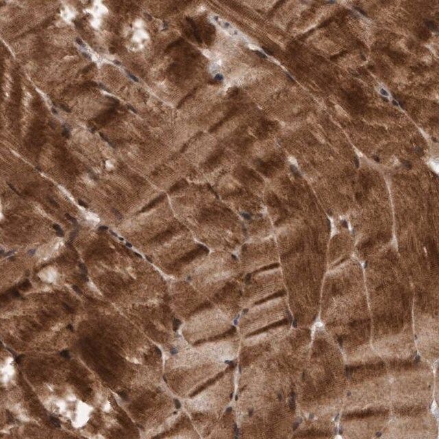 Anti-MLXIP antibody produced in rabbit