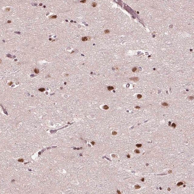 Anti-MED6 antibody produced in rabbit