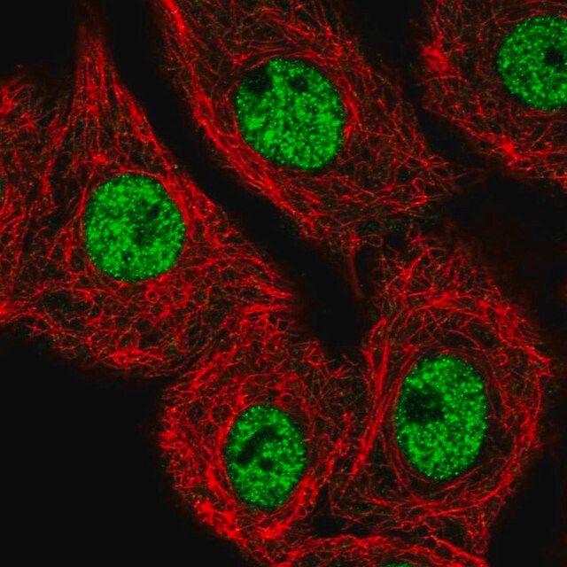 Anti-MED25 antibody produced in rabbit