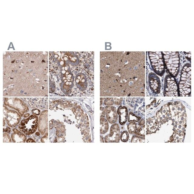 Anti-MECR antibody produced in rabbit