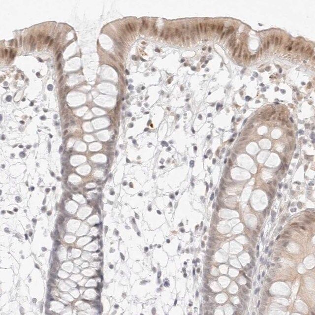 Anti-MED18 antibody produced in rabbit