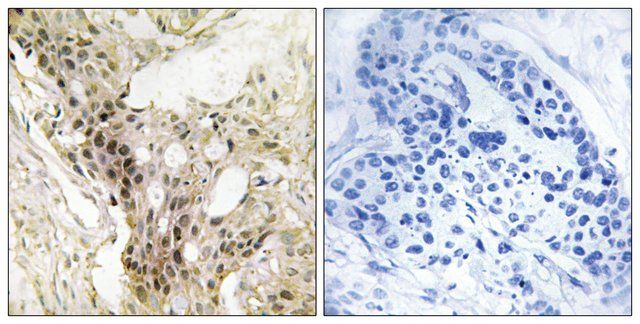 Anti-MED21 antibody produced in rabbit