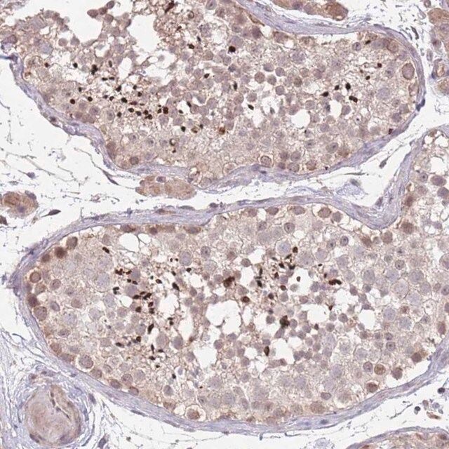 Anti-MEI1 antibody produced in rabbit