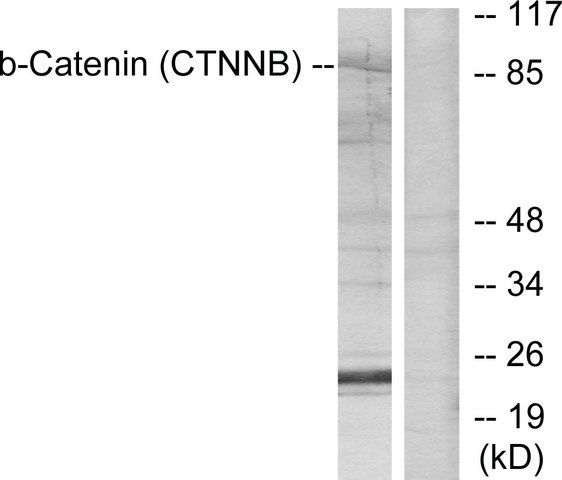 Anti-Catenin-β antibody produced in rabbit