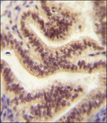 ANTI-CP045 (CENTER) antibody produced in rabbit