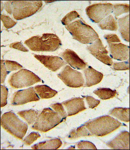 ANTI-CTSF (CENTER D276) antibody produced in rabbit