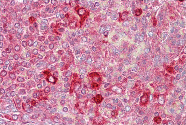 Anti-CUGBP2 antibody produced in rabbit