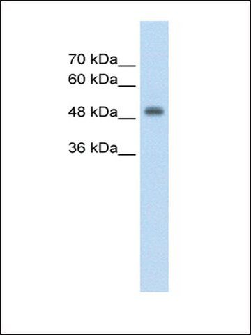 Anti-CUEDC1 antibody produced in rabbit