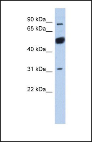Anti-CXORF20 antibody produced in rabbit