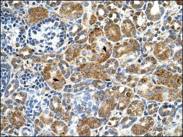 Anti-CSTB (AB1) antibody produced in rabbit