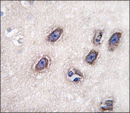 Anti-CYP2U1 (center E202) antibody produced in rabbit